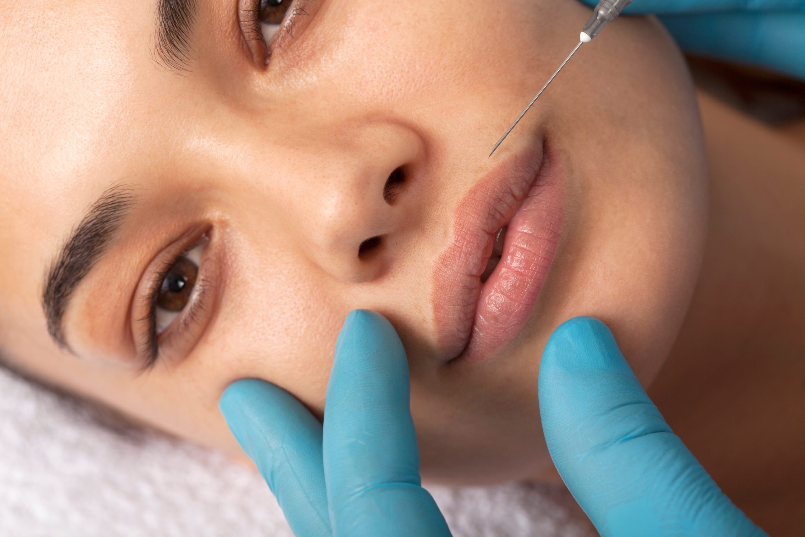injections visage